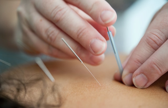 The Best Time To Get Acupuncture For Fertility