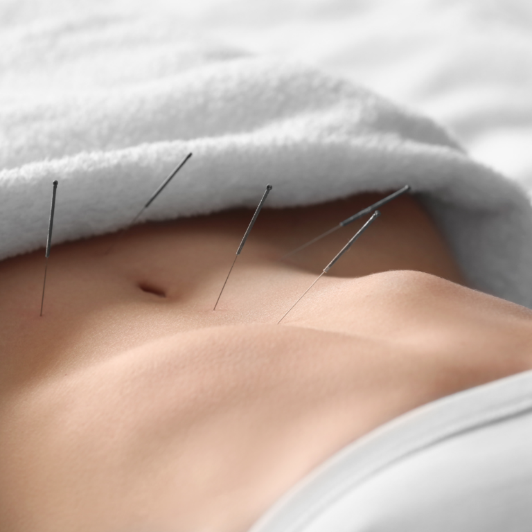 Boost Your IVF Success: The Power of Acupuncture Before Frozen Embryo Transfer