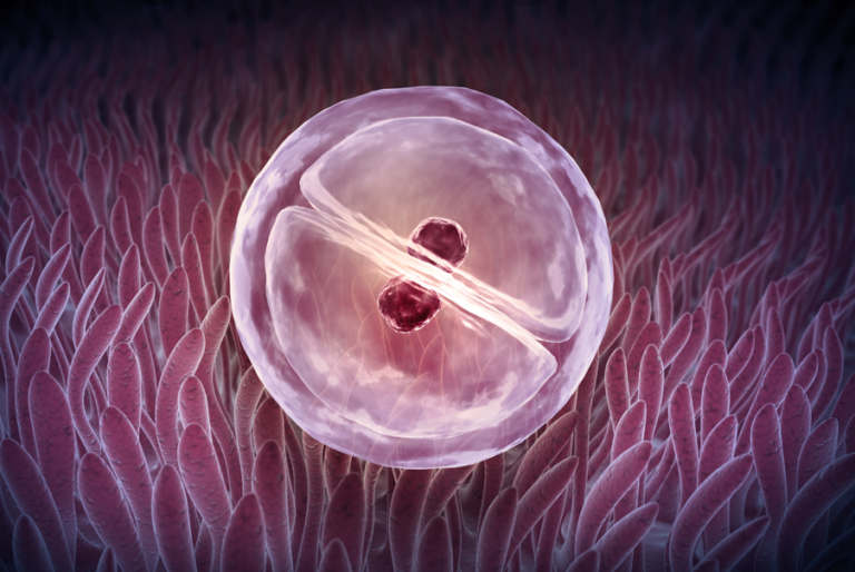 How to Address Polycystic Ovary Syndrome (PCOS) Ovulatory Disorders and Infertility