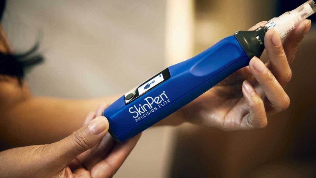 Microneedling treatment with the SkinPen Precision Elite at Acubalance